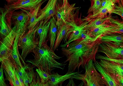Fluorescence microscopy image of fibroblasts in culture.